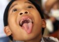 The Fluoride Question: Why Is It Still in Our Water?