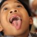 The Fluoride Question: Why Is It Still in Our Water?